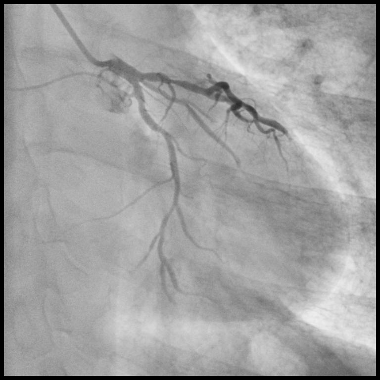 angiography system.jpg angiography system.jpg
