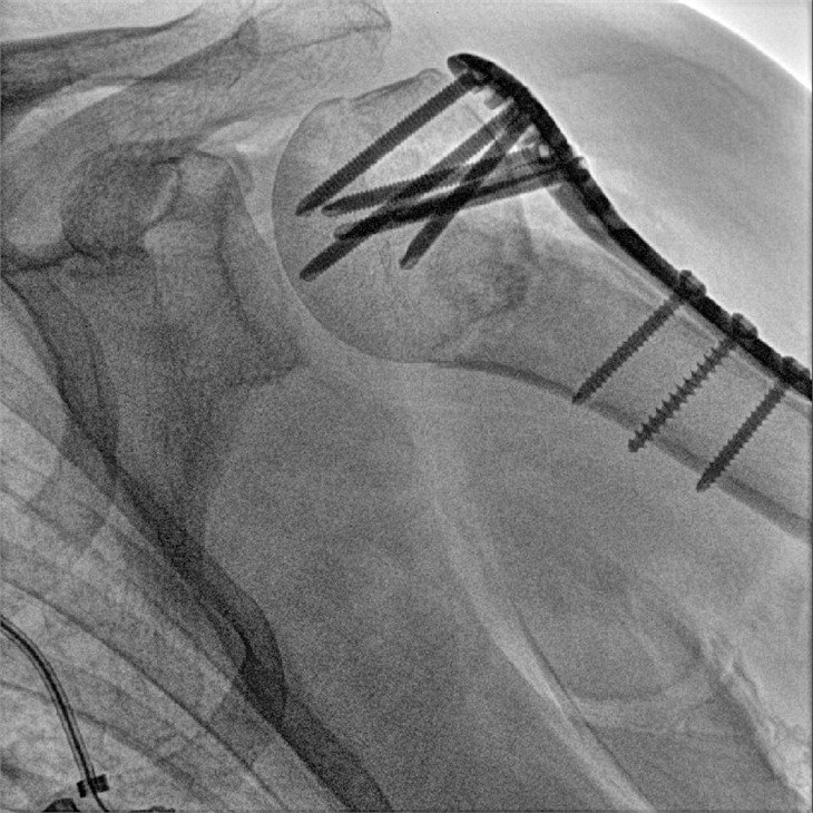 orthopedic department